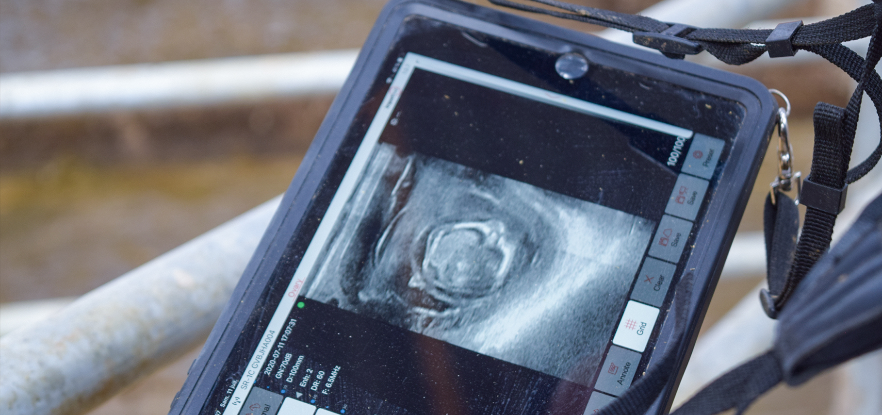 Photo échographe en plein constat de gestation